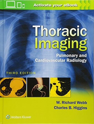Tapa de Thoracic imaging : pulmonary and cardiovascular radiology