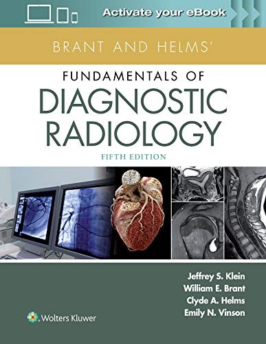 Tapa de Fundamentals of Diagnostic Radiology