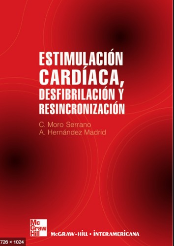 Tapa de Estimulación cardiaca, desfibrilación y resincronización